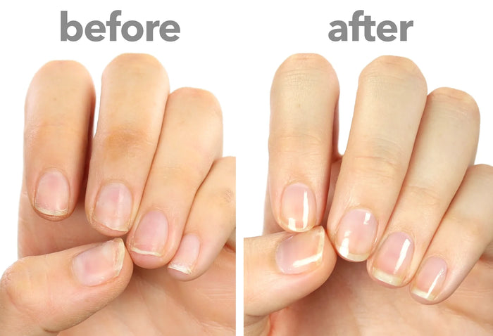 Long Healthy Nails
