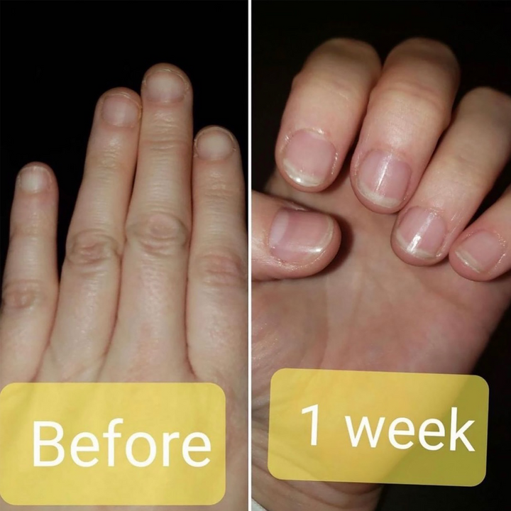 Damage Control nail strengthener before and after 1 week on damaged nails