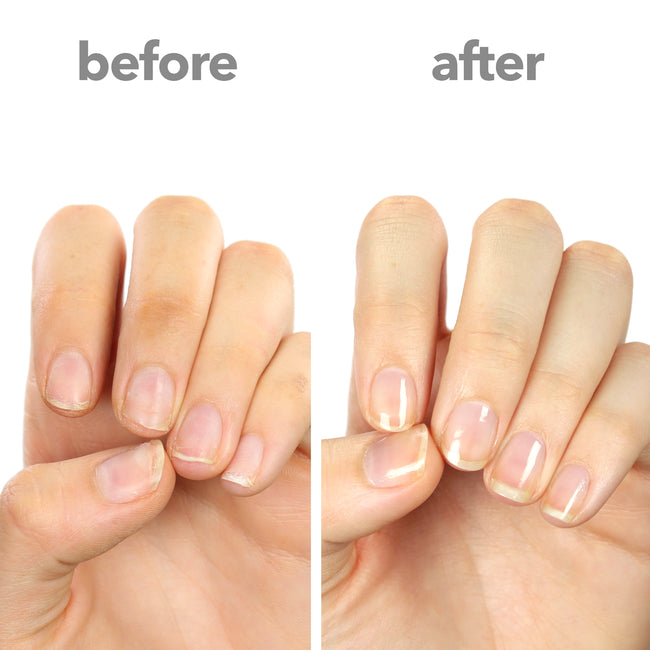 4 DIY Nail Strengtheners You Can Try at Home