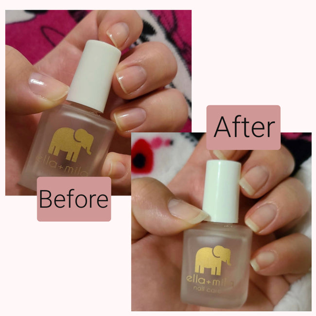 First Aid Kiss (Nail Strengthener)