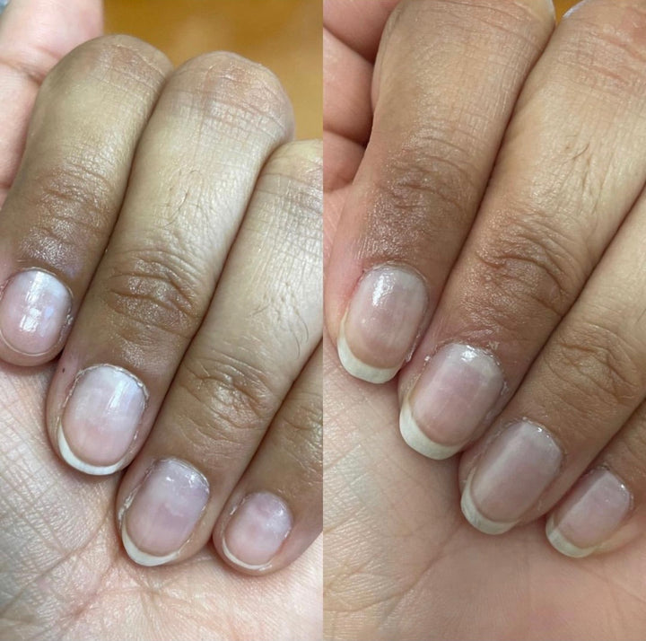 Damage Control nail strengthener before and after comparison on peeling nails