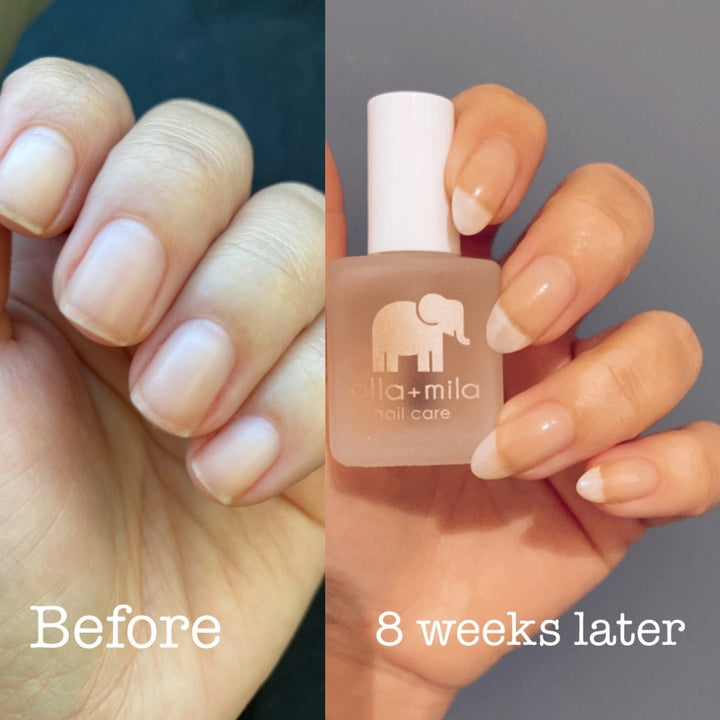 Damage Control nail strengthener before and 8 weeks later, holding the bottle